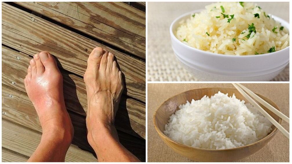 Хворим на подагру рекомендується дієта на основі рису